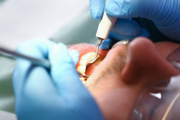 Best Emergency Denture Repair in Chevy Chase View, MD