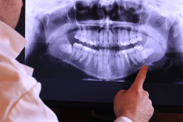 Best After-Hours Dental Trauma Care in Chevy Chase View, MD