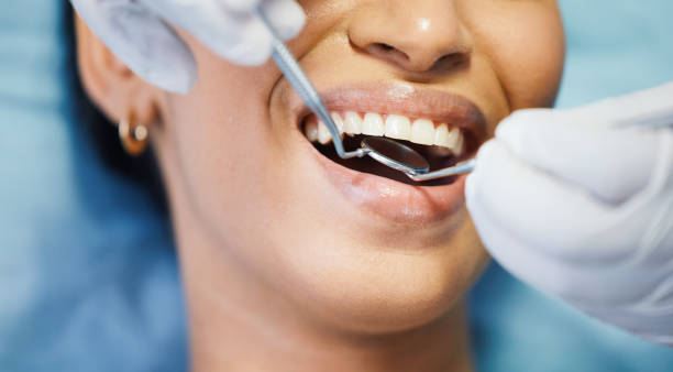 Best Urgent Care for Lost Fillings or Crowns in Chevy Chase View, MD